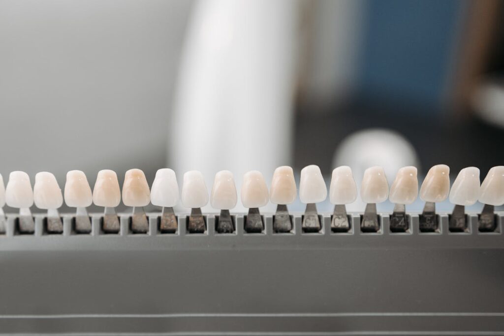 Zahnersatzpalette mit Zähnen in verschiedenen Farbstufen